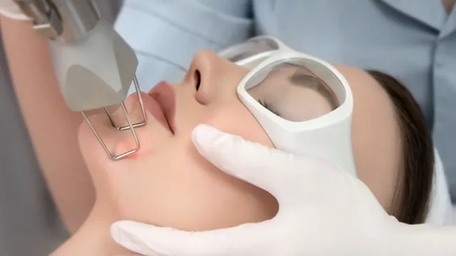 ¿Quién te hizo la carita? El boom del tratamiento con láser CO2 (cuánto cuesta la terapia y sus riesgos)